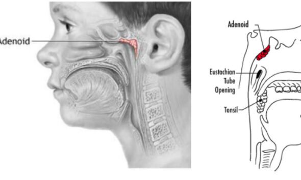 Adenoidid