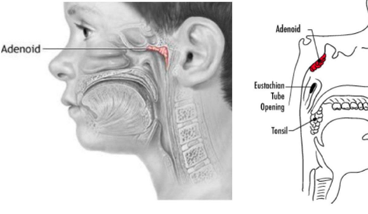 Adenoidid