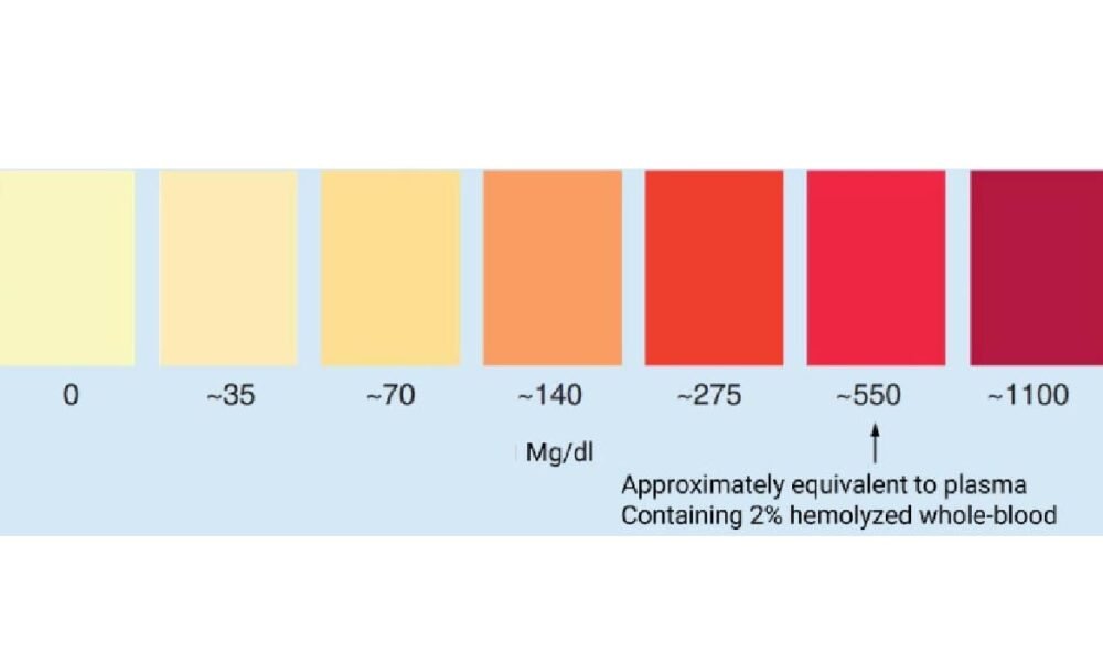 Gergerg How Does Blood Hemolyzing Affect Bioanalysis Accuracy? - Cooper Magazine